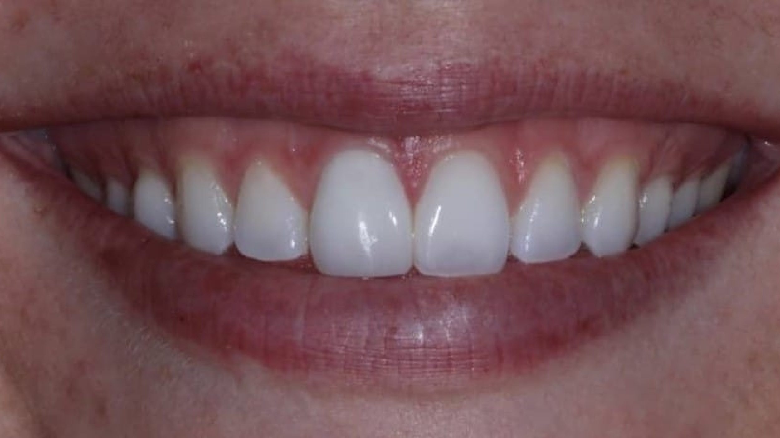 after one